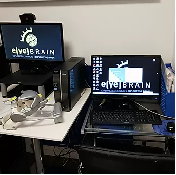 img_eyebrain